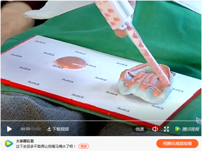 全口義齒取模流程  